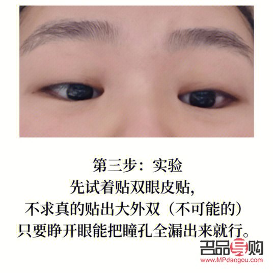 解決單眼皮腫眼泡的有效方法