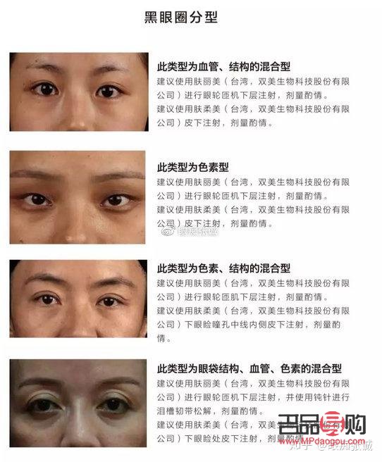 深圳去除眼袋黑眼圈哪里最好(深圳去除眼袋黑眼圈哪里最好的醫(yī)生)