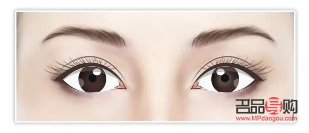 <h3>歐式大寬雙眼皮：魅力之眼的新風(fēng)尚</h3>