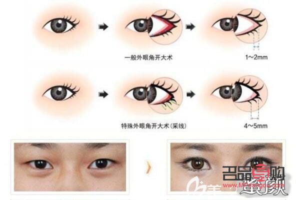 外眼角很大屬于什么眼型
