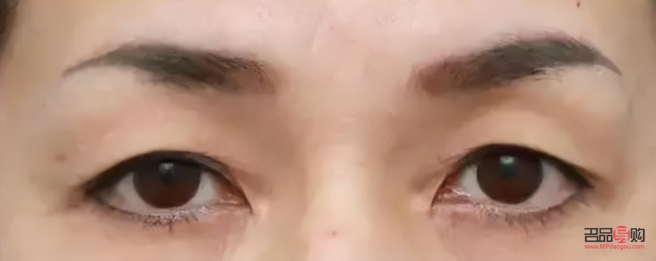 眼皮下垂怎么自然恢復(眼皮下垂怎么自然恢復小妙招)