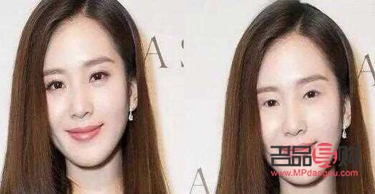 單眼皮變雙眼皮(單眼皮變雙眼皮了怎么回事)