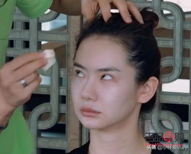 雙眼皮手術有沒有后遺癥呢圖片(雙眼皮手術有沒有后遺癥呢圖片大全)