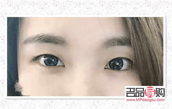 割雙眼皮加開眼角價(jià)位(割雙眼皮加開眼角價(jià)格)