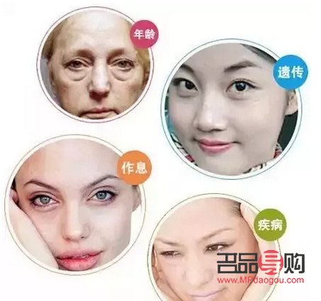 眼袋的克星是什么藥膏(眼袋大是身體哪里出現(xiàn)了問題)