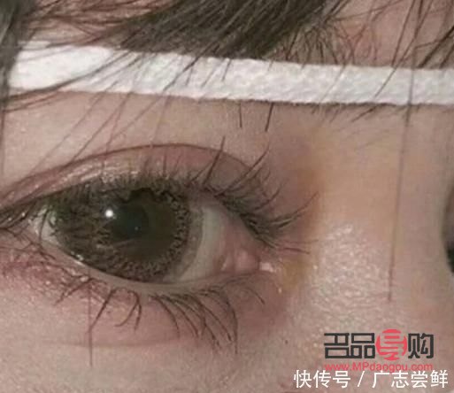 天生腫眼泡怎么按摩可以變薄(天生腫眼泡怎么按摩可以變薄一點)