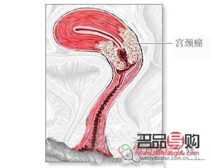 <h3>刮宮后身體護理全攻略</h3>