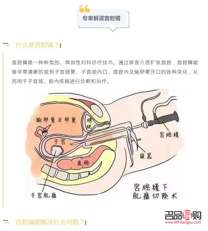 刮宮后身體護理全攻略