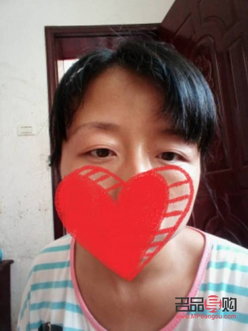 雙眼皮松弛下垂最好解決方法(雙眼皮松弛下垂最好解決方法做手術(shù)會(huì)難看嗎)