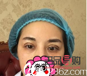 西安市做雙眼皮哪家好(西安市做雙眼皮哪家好一點)