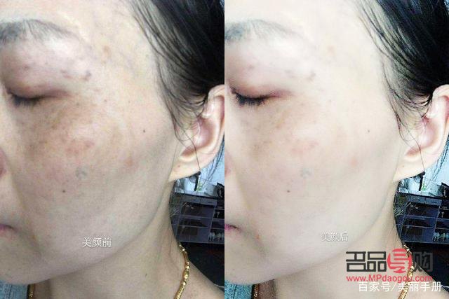 <h3>美容院能否有效去除肌膚暗黃？</h3>