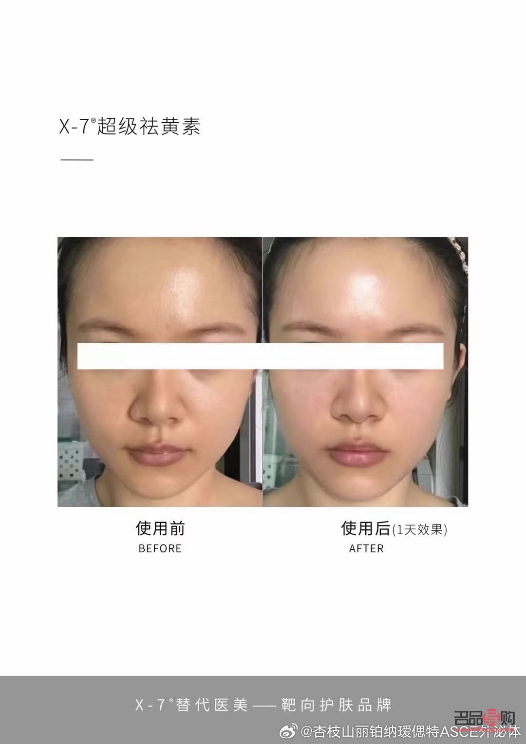 美容院能否有效去除肌膚暗黃？