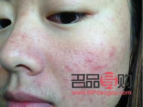 干性皮膚身體怎么護(hù)理(干性皮膚身體怎么護(hù)理最好)