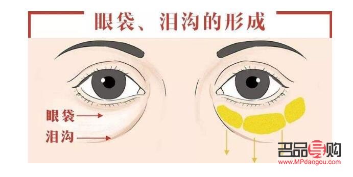 眼袋咋去掉(眼袋咋去掉視頻)