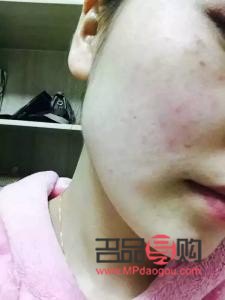 如何查彩妝過敏(如何查彩妝過敏原因)