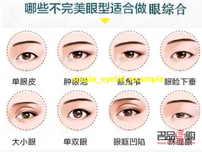 單眼皮眼型的種類圖解(單眼皮眼型的種類圖解大全)