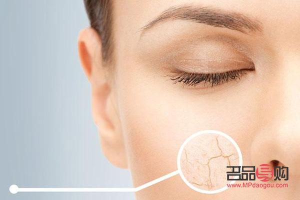 <h3>身體干燥起皮，呵護肌膚有妙招</h3>