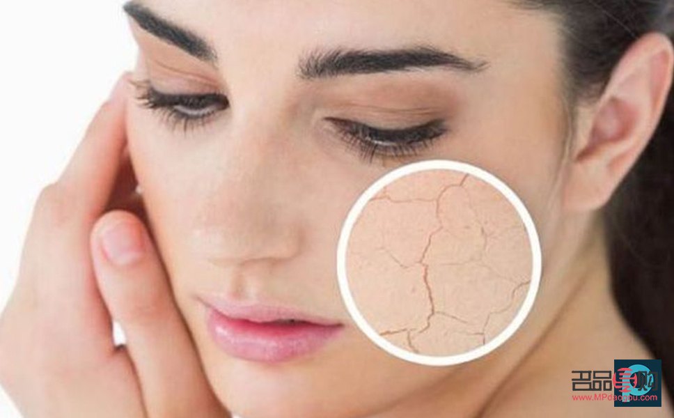 <h3>身體干燥起皮，呵護肌膚有妙招</h3>