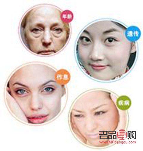 一只眼睛下眼瞼突然腫了圖片(一只眼睛下眼瞼突然腫了圖片女)