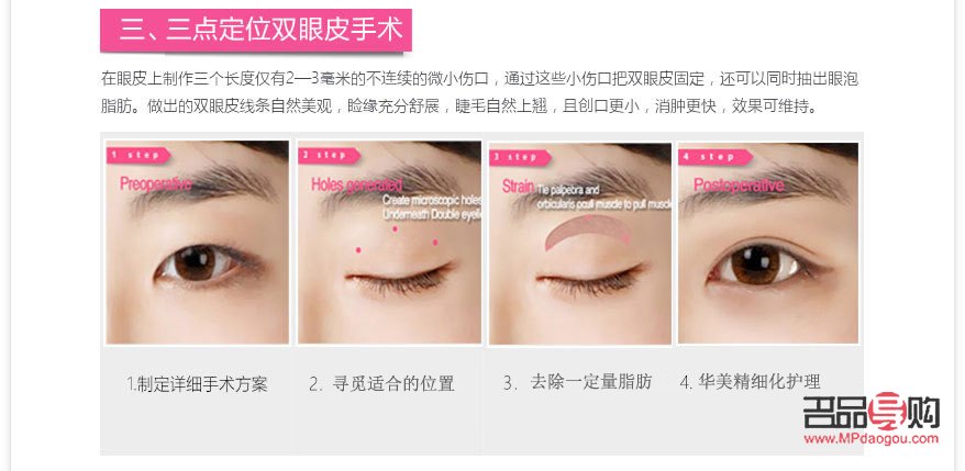 <h3>雙眼皮手術對老年時期的影響探究</h3>