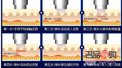 <h3>微針后的身體護理全攻略</h3>