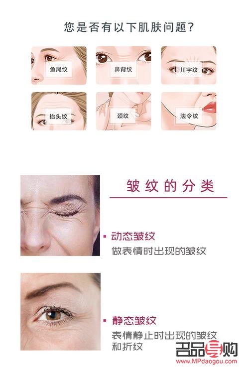 探尋去眼下皺紋的費用之謎