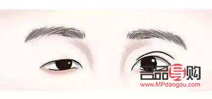 <h3>大小眼問題是否可通過雙眼皮手術(shù)改善？</h3>