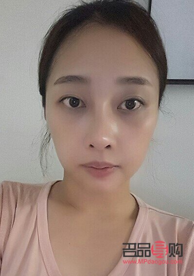 割雙眼皮有哪幾種眼型(割雙眼皮有哪幾種眼型好看)