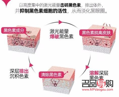 眼部黑色素代謝不出來怎么辦(黑眼圈激光一次多少錢)