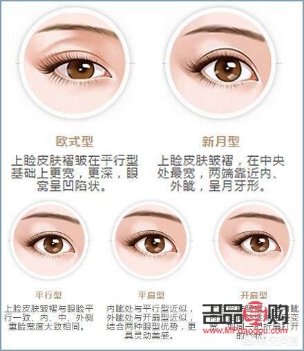 如何變成雙眼皮不用割(如何變成雙眼皮不用割簡單)