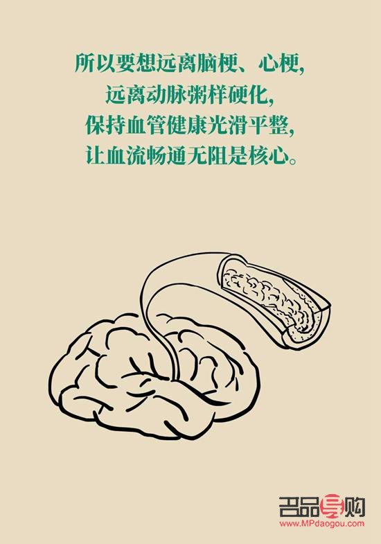 <h3>腦?；颊咚投Y指南</h3>