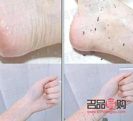 <h3>身體護(hù)理搓泥怎么辦？教你幾招輕松應(yīng)對(duì)！</h3>