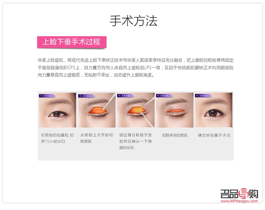 <h3>眼部抽脂手術(shù)費(fèi)用及注意事項(xiàng)</h3>