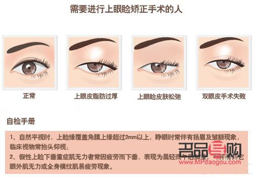 <h3>眼角下垂鍛煉秘籍：重拾青春眼神</h3>