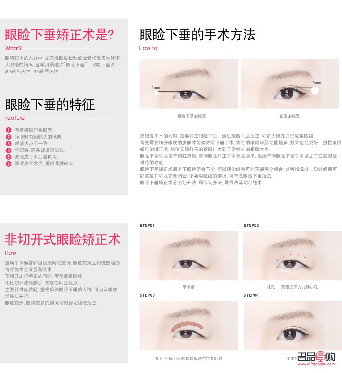 <h3>眼角下垂鍛煉秘籍：重拾青春眼神</h3>