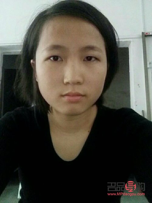 天生腫眼泡怎么治(天生腫眼泡怎么治呀)