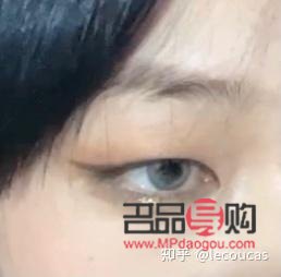 天生腫眼泡怎么治(天生腫眼泡怎么治呀)