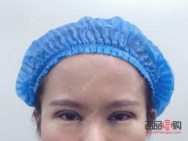 <h3>探索6.5毫米雙眼皮的魅力</h3>