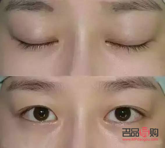 雙眼皮的人多還是單眼皮的人多(世界上雙眼皮的人多還是單眼皮的人多)