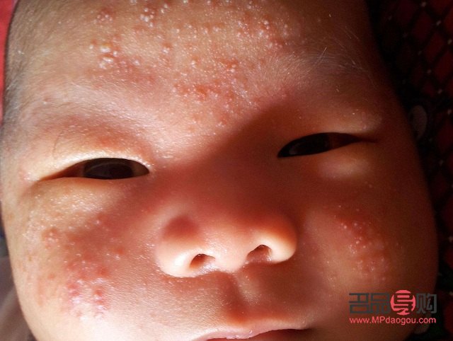 春季身體護(hù)理做什么(春季身體護(hù)理做什么好)