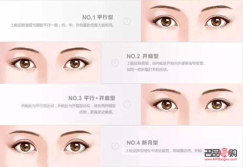 <h3>雙眼皮種類圖片全解析</h3>
