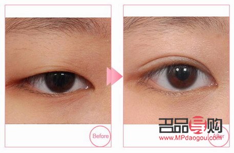 <h3>6D翹睫雙眼皮：美麗背后的考量</h3>