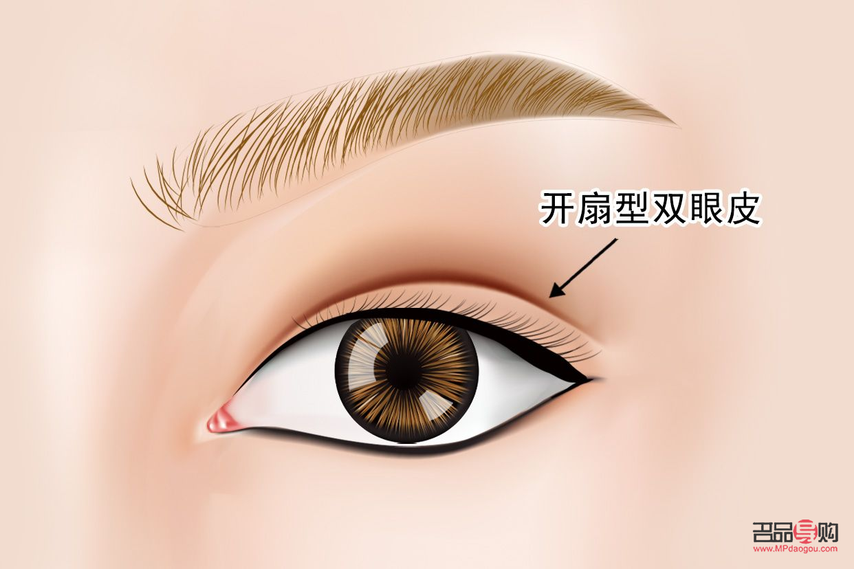 廣尾式雙眼皮(廣尾式雙眼皮圖片)