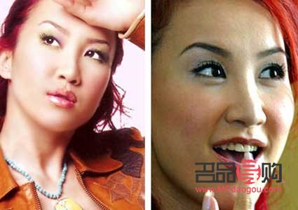 <h3>選擇雙眼皮貼，打造迷人電眼</h3>