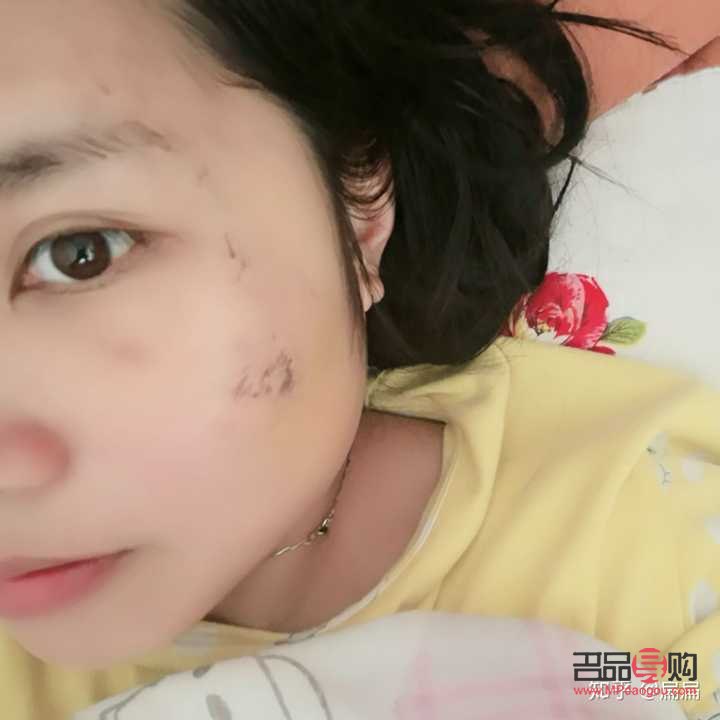 彩妝如何遮疤痕(彩妝如何遮疤痕呢)