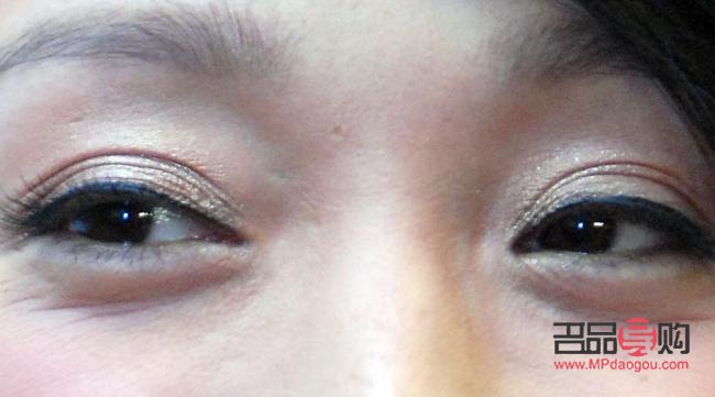 下眼袋處腫了像蚊子包怎么辦(下眼袋處腫了像蚊子包怎么辦用什么藥)