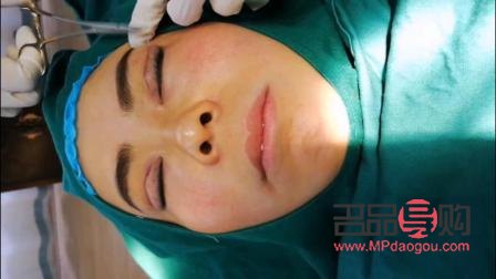 雙眼皮做窄了還能加寬嗎(雙眼皮做窄了還能加寬嗎視頻)