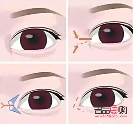 <h3>開眼角與不開眼角的區(qū)別圖解</h3>