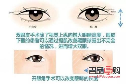 <h3>開眼角與不開眼角的區(qū)別圖解</h3>