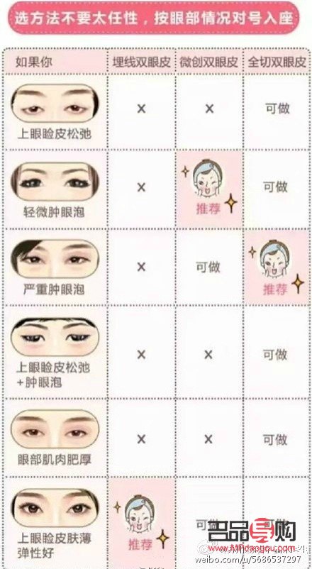 <h3>雙眼皮是什么眼睛</h3>